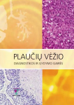 Plaučių vėžio diagnostikos ir gydymo gairės