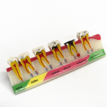 1 piece Dental Teeth Model Periodontal Disease Assort Tooth Classification Model Typodont Dental Teaching Display Model 1 piece A