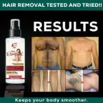 Belissima Hair Vanish Spray: Effortlessly smooth, this revolutionary hair removal spray ensures silky skin in seconds-100ml 100ml