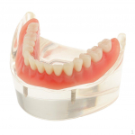 Burnos dantų tyrimo mokymo demonstracinis modelis Overdenture Inferior 2 implantų demonstracinis mokymas &ndash;