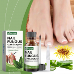 Kojų nagų grybelio gydymas, ypač stiprus, nagų gydymas, nagų priežiūros priemonė, ypač stipri storiems, pakitusios spalvos ir pažeistiems nagams, 30 ml balta
