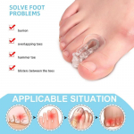 Kojų pir&scaron;tų padalijimo korektorius Big Foot Bone Orthosis Clip kojos pir&scaron;tas