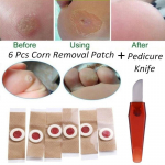 6 vnt./komplektas Foot Corn Removal Killer Calluses Plantar