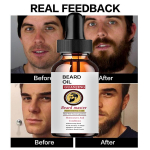 Beard Growth Oil Spray Greito plaukų augimo eterinių aliejų esencijos serumas tir&scaron;tesnės pilnesnės barzdos drėkinamasis plaukų augimo aliejus 5ml