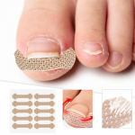 Įaugusių nagų lipdukai One Size balta