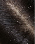 NURME - Hair Care dovanų rinkinys For Irritated Scalp