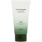 Heimish Matcha Biome Amino Acne Cleansing Foam &ndash; veido prausiklis 150g