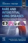 KNYGA Claudio Sorino Rare and Interstitial Lung Diseases