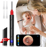 Veido valymo priemonės Belaidis otoskopas &ndash; HD WiFi ausų va&scaron;ko &scaron;alinimo įrankis su LED lempute, saugus pasirinkimas